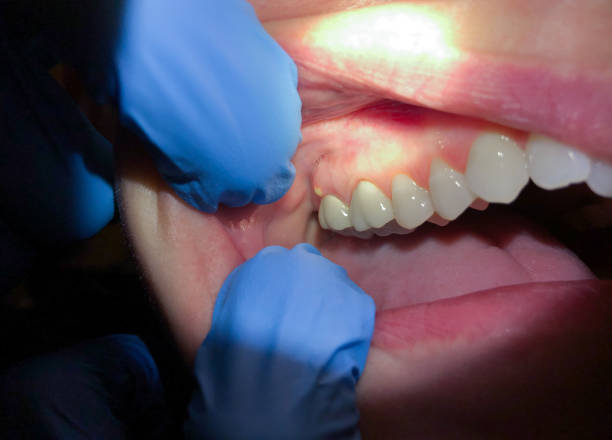 Best Walk-In Emergency Dentist in Rosemead, CA